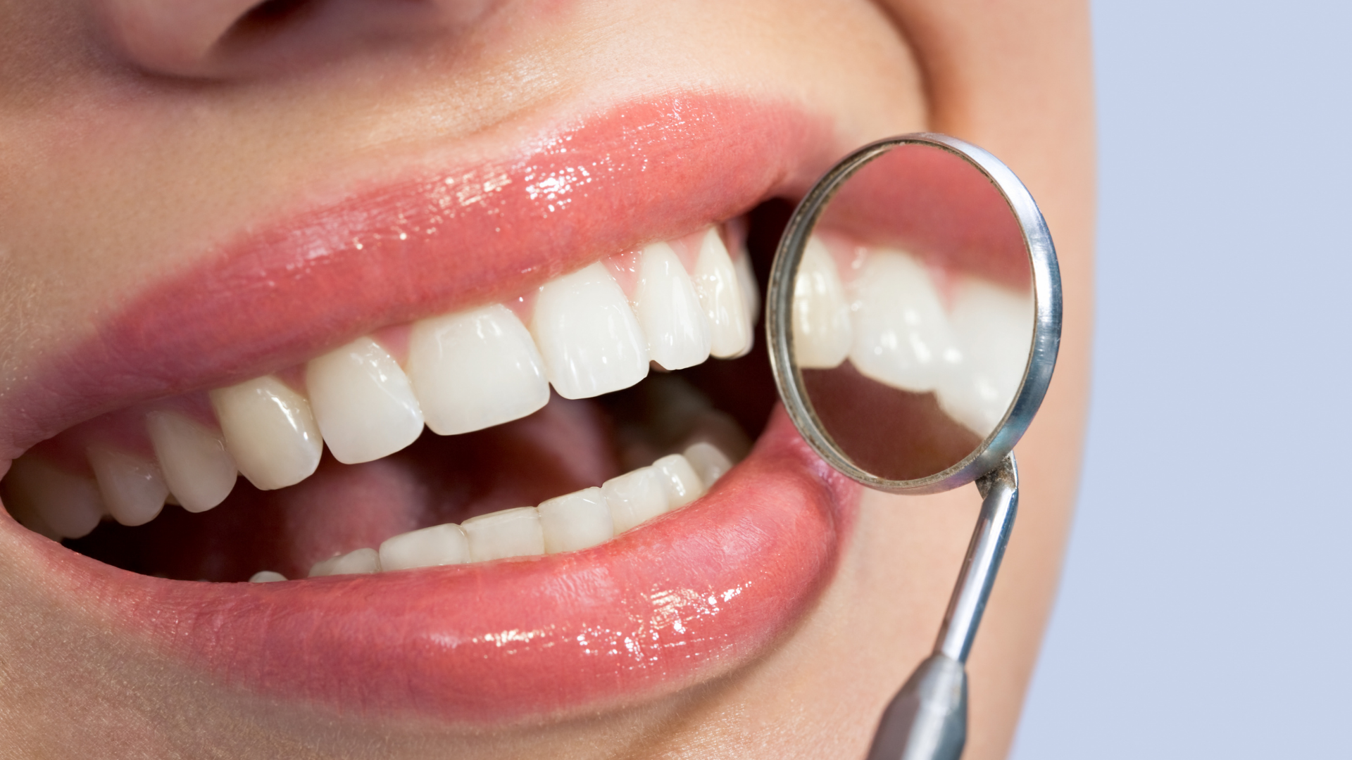 Composite Bonding: A Complete Guide