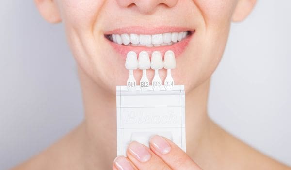 Everything You Need to Know About Veneers